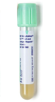 Thyroid Stimulating Hormone 3rd Generation - MU Health Care Laboratory